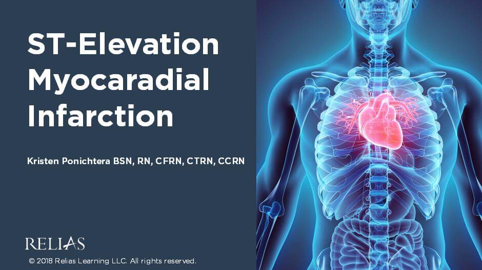 ST-Elevation Myocardial Infarction (STEMI) | RELIAS ACADEMY