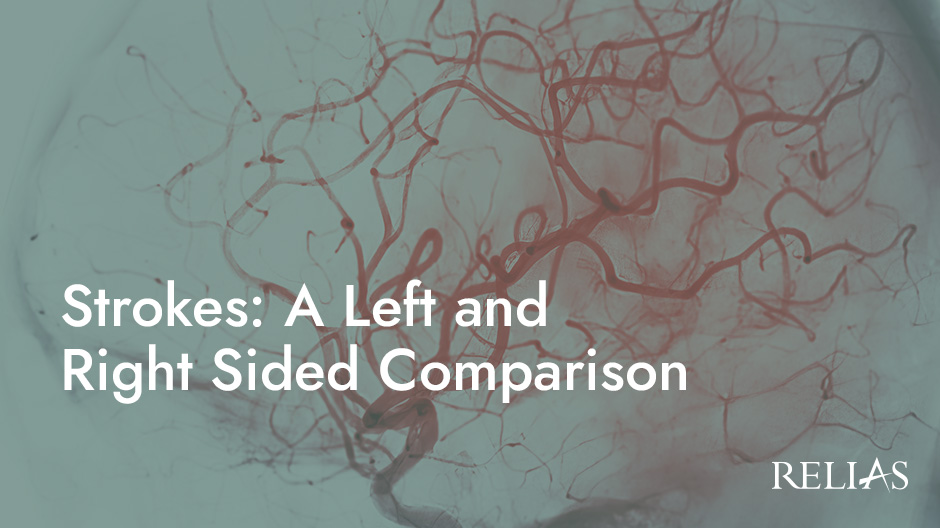 Strokes: A Left and Right Sided Comparison | Relias Academy