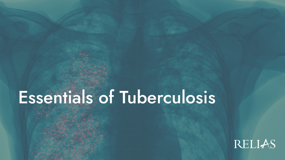 Essentials of Tuberculosis