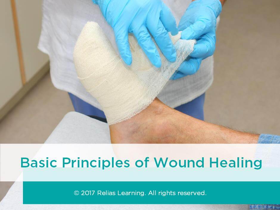 Basic Principles Of Wound Healing | RELIAS ACADEMY